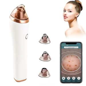 Buy Home Use Electric Blackhead Remover Machine USB Rechargeable Whitehead Blackhead Removal with Camera App
