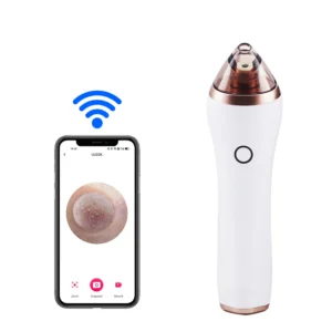 Electric Dermabrasion Handset Mini Skin Peeking Pore Cleaner Beauty Machines Facial Visible Blackhead Remover Vacuum